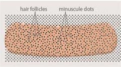 عکس گرافیکی نقاط فولیکول مو در کاشت ریش و سبیل به روش fit